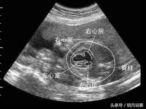 ̥��28���� ��άͼһ�� ׼������ ҽ����һ�� һ������������