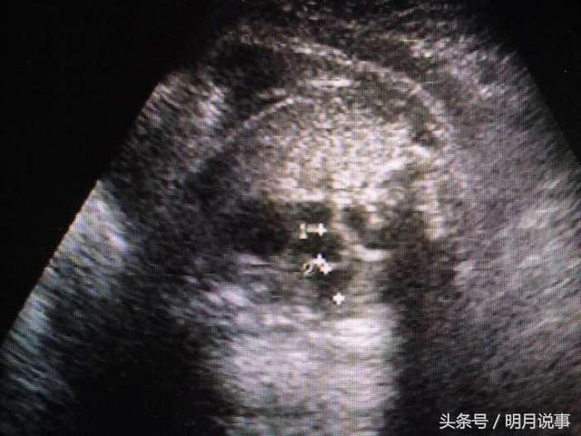 ̥��28���� ��άͼһ�� ׼������ ҽ����һ�� һ������������