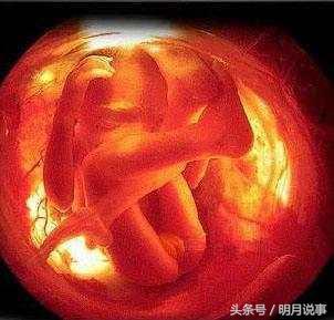 ̥��28���� ��άͼһ�� ׼������ ҽ����һ�� һ������������