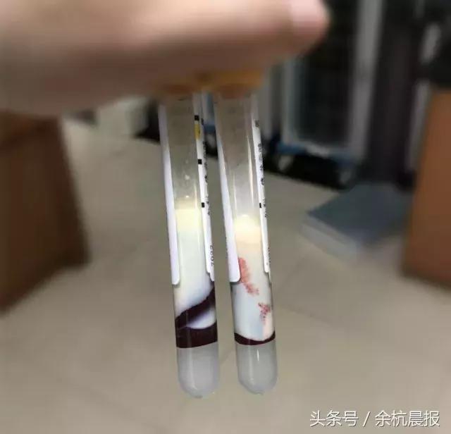 �ຼС��ҹ����ʹ���̣�ȥҽԺ���������Ѫ�������ֲ���������